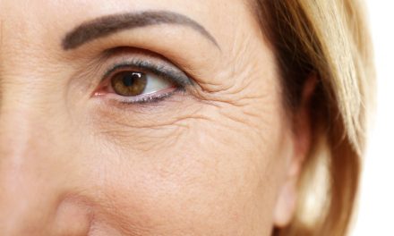 Dark Eye Circles – Do Genetics Matter?