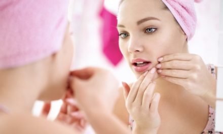 How to Choose Natural Skin Care Products for Acne-Prone Skin