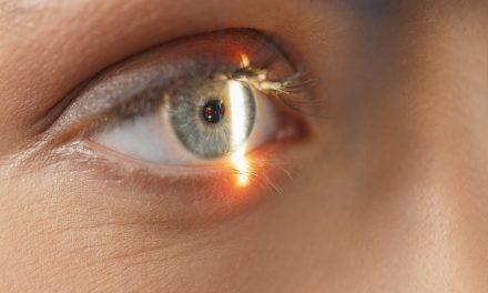 How a laser vision correction is made?